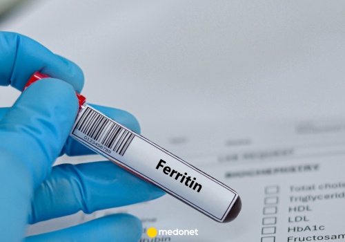 Kiedy poziom ferrytyny jest za niski? Diagnostka wyjaśnia
