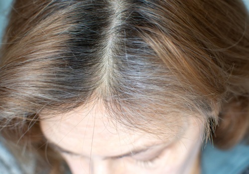 Przełom w walce z siwizną. Nie tylko farba zmienia kolor. Dzięki tej witaminie włosy ciemnieją