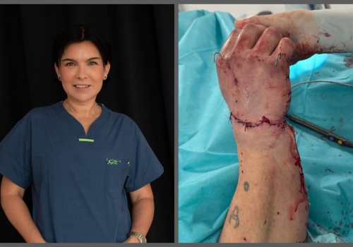 Miała dzień wolny, uratowała przyniesioną w worku odciętą dłoń. Znów o lekarce z Limanowej mówi cała Polska