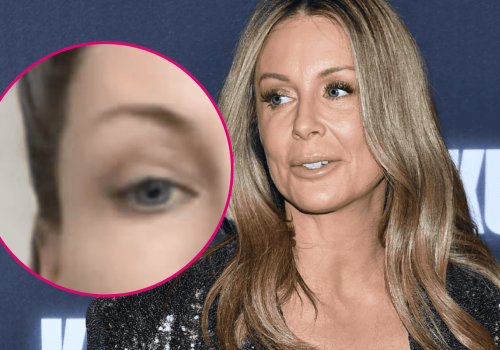 Małgorzata Rozenek-Majdan bez makijażu. Jak naprawdę wygląda cera gwiazdy z bliska?