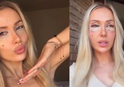 Eliza Trybała poddała się PLASTYCE POWIEK! Zainspirowała się znaną koleżanką: 