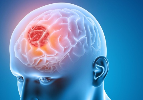 Komórki odpornościowe robią coś dziwnego, aby powstrzymać pasożyta mózgu