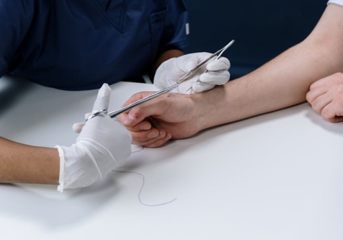 Bezbolesny plaster monitoruje zdrowie układu odpornościowego bez pobierania krwi i biopsji