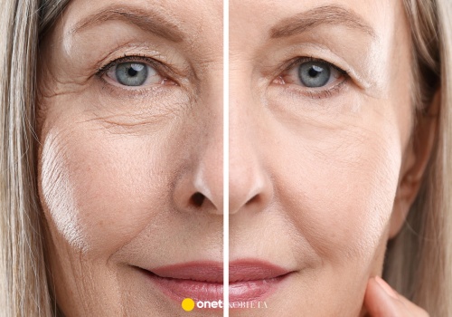 Ten booster z kawiorem i jadem żmii prasuje zmarszczki mimiczne jak niewidzialne żelazko