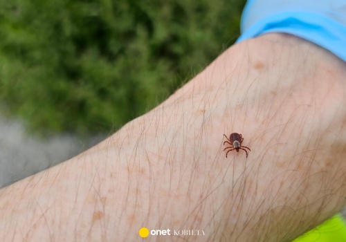 Ukąszenie kleszcza może wywołać alergię pokarmową