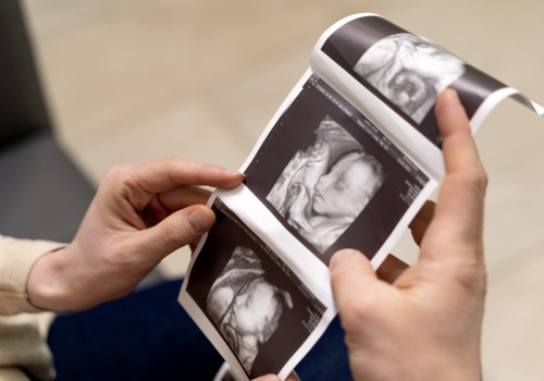 O. Samuel Karwacki OSPPE: modlitwa jest potężnym orężem w obronie życia