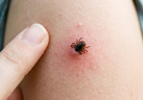 Kleszcz-gigant dotarł do Polski. Egzotyczny intruz jest bardzo mobilny