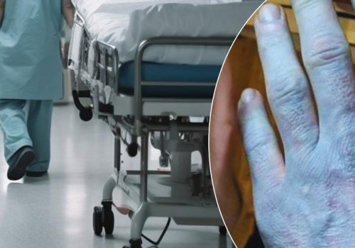 Obudził się niebieski, zszokował lekarzy. To nie problemy z krążeniem