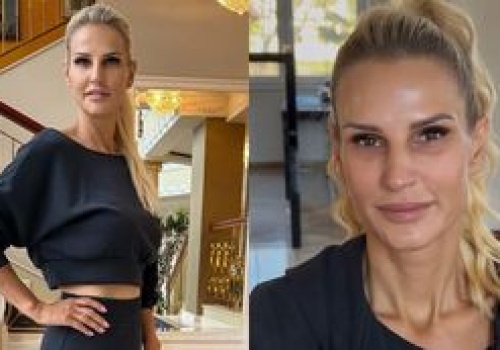 Szczuplejsza aż o 42 KILOGRAMY Dominika Tajner rozprawia o plastyce brzucha w Turcji: 