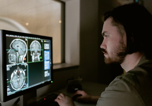 Nowy odczynnik sprawia, że mózgi stają się przezroczyste. Przełom w obrazowaniu neuronów