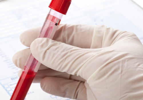 To dlatego nie możesz schudnąć. Najsilniejszy przeciwnik odchudzania