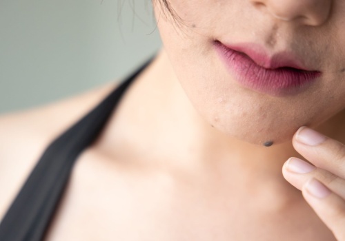 Ma je prawie każdy. To odróżnia 