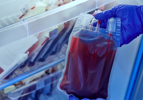 Ta grupa krwi zwiększa ryzyko udaru. Naukowcy wyjaśnili przyczynę