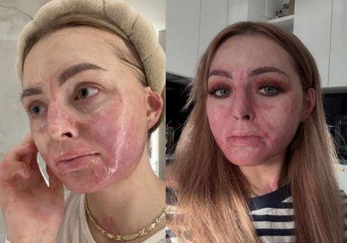 Ten grill pod Włodawą zmienił życie tiktokerki na zawsze. Zapewnia, że żadnych mediacji nie będzie