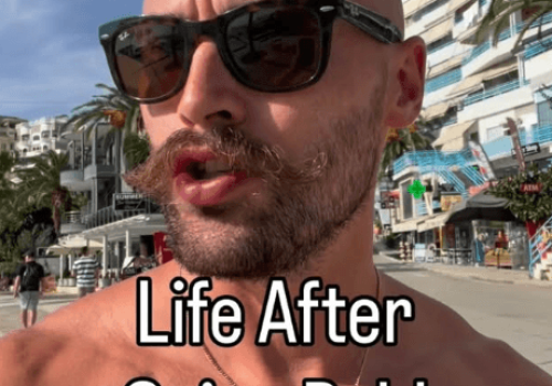 Zamiast bać się łysienia, chwalą się gładką głową. Czym jest „baldmaxxing”?