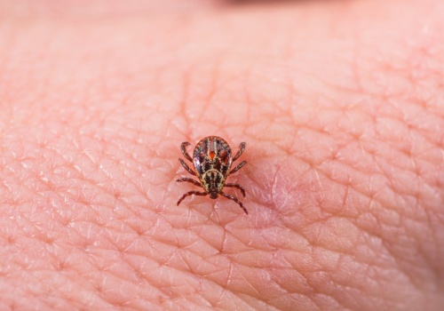 Nowa nadzieja w walce z boreliozą. Szczepionka skuteczna w badaniach