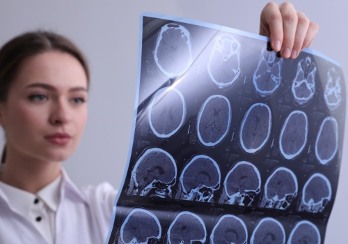 AI oszukuje lekarzy. RTG nie do odróżnienia od prawdziwych