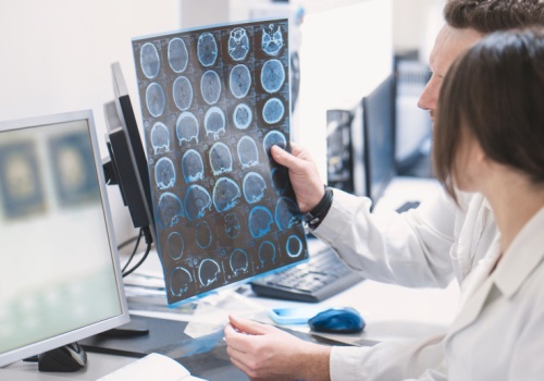 Choroba Alzheimera: są nowe terapie, ale system nie nadąża za postępem. 