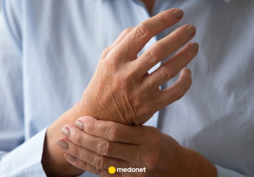 Takie objawy daje toczeń na wczesnym etapie. Zwróć uwagę na te znaki