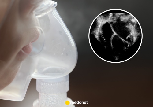 Najpierw pojawił się suchy kaszel. Szanse Maxa na przeżycie wynosiły tylko jeden do trzech