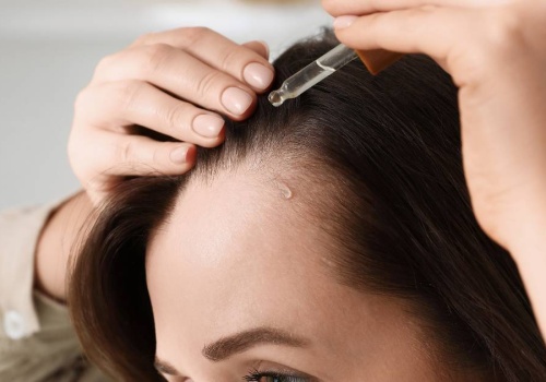 Remedium na łysienie! Ta wcierka do włosów działa cuda na zakola - daje wysyp baby hair