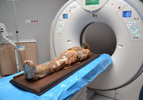 Egipska mumia pod lupą radiologów z Lublina. Niezwykła współpraca medycyny i nauki