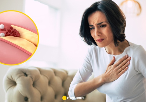 Wysoki cholesterol to sygnał ostrzegawczy. Lekarz mówi, kiedy nie wolno go ignorować