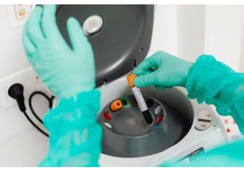 Bezpłatne badania laboratoryjne dla mieszkańców Małej Nieszawki. Ruszył program profilaktyczny