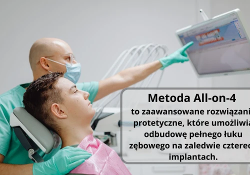 Na czym polega metoda All-on-4 i jakie są jej etapy