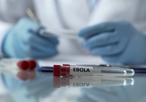 Wkrótce rozpoczną się badania kliniczne szczepionki przeciwko Eboli na ludziach w Wielkiej Brytanii