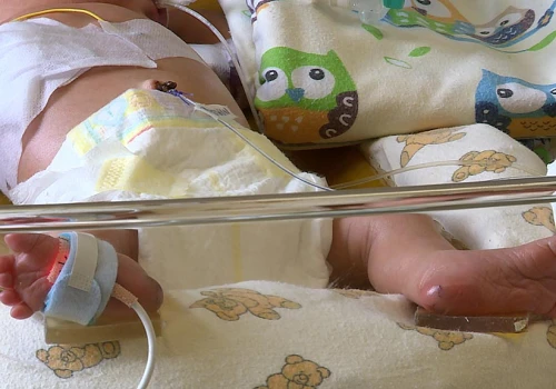 Uratowali życie 600 gramowemu dziecku
