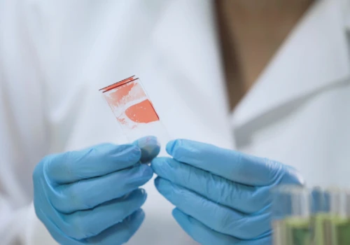Terapia podskórna dla pacjentów z hemofilią ograniczona. Wciąż nie ma decyzji