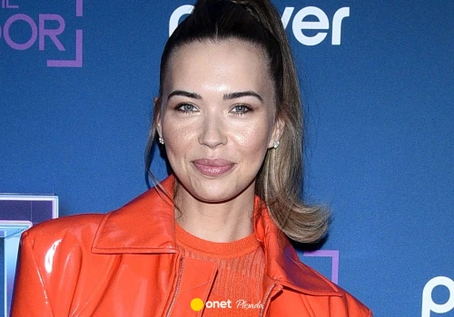 Sandra Kubicka poddała się zabiegowi i pokazała efekty. 