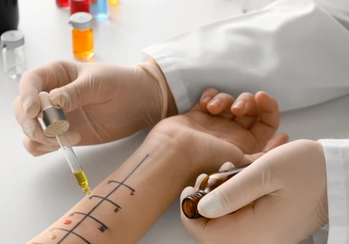 160 tys. osób rocznie na terapii odczulającej. Stawka degresywna zamknie poradnie alergologiczne?