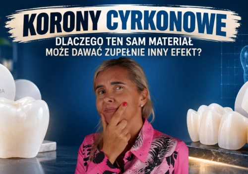 Korony cyrkonowe – dlaczego ten sam materiał może dawać zupełnie inny efekt?