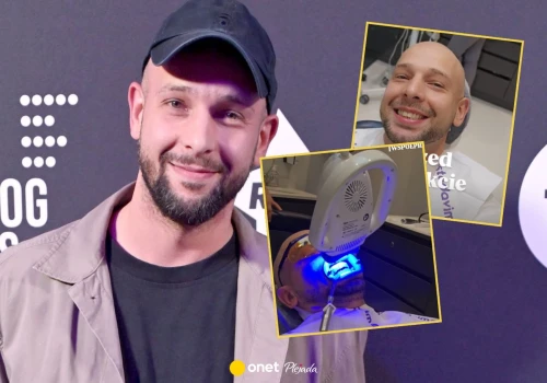"Obniża moją pewność siebie". Maciej Pela zdecydował się na zabieg w Turcji