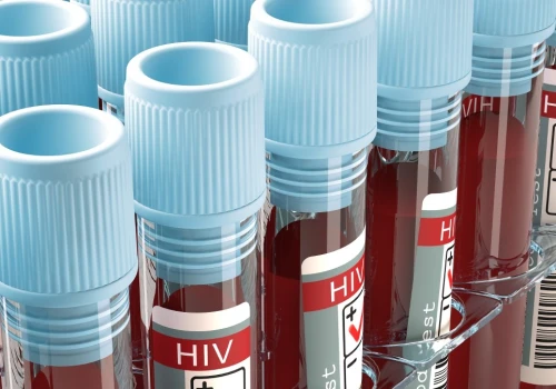 Nowa metoda leczenia HIV. Chodzi o przeciwciała do walki z wirusem