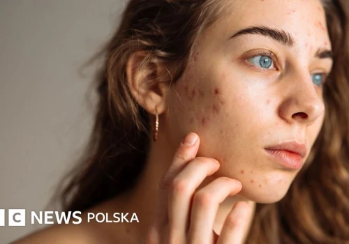 Prosta pielęgnacja skóry dla nastolatków, która naprawdę działa