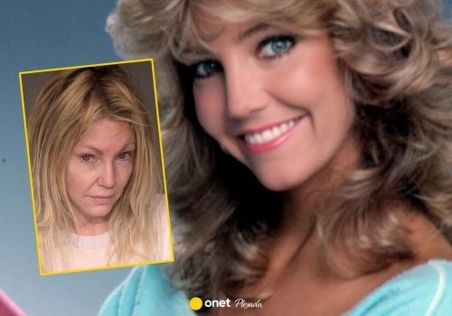 W latach 80. Heather Locklear zachwycała urodą. Potem przestała przypominać siebie