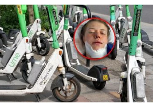 Miała wypadek na hulajnodze elektrycznej. 