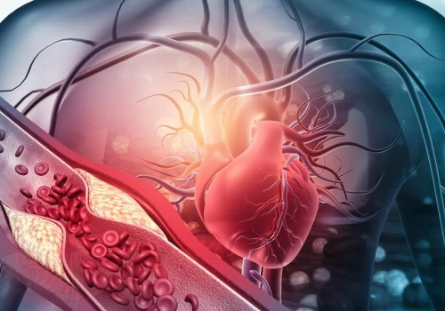 Wyższy poziom cholesterolu wiąże się z dłuższym życiem