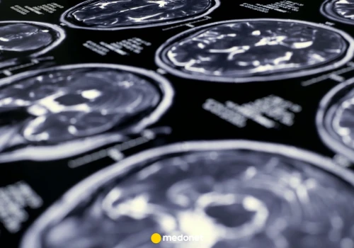 Nagroda Nobla 2026 za przełom w badaniach neurologicznych. 