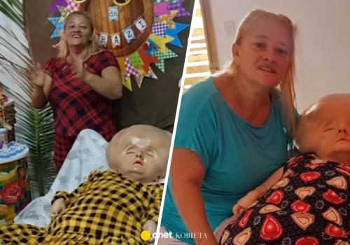 Lekarze nie dawali jej trzech miesięcy życia. Dziś Brazylijka świętuje 33. urodziny