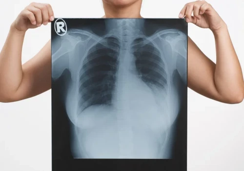 W Polsce codziennie 60 kobiet dowiaduje się o tym nowotworze