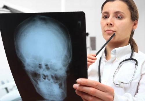 143 miejsca, 19 chętnych. Młodzi lekarze omijają onkologię