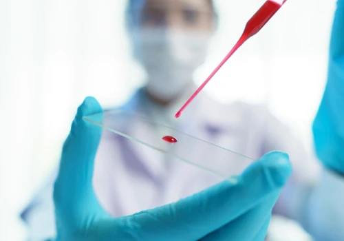 Jedna kropla krwi i 10 minut. Szybki test pomoże ratować rannych