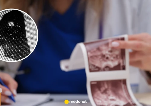 Tę chorobę wykryto u papieża Leona XIV. Objawy gruczolakoraka bywają mylące