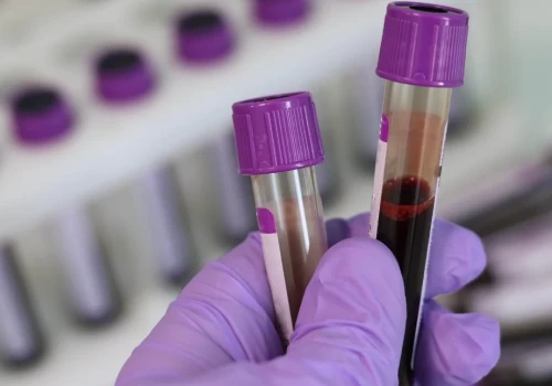 Nowe laboratoria i poradnie onkologiczne we Wrocławiu. Szpital przy Kamieńskiego chce szybciej diagnozować raka
