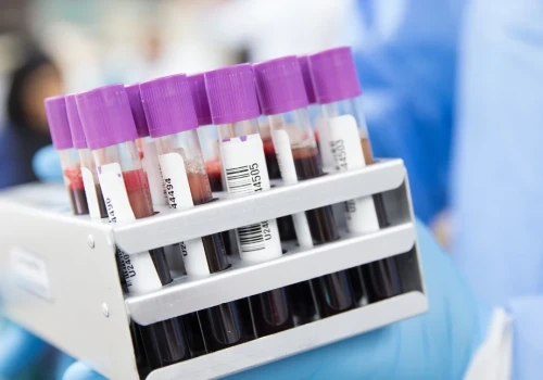 W Polsce brakuje hematologów. Prof. Marcin Pasiarski ostrzega przed problemami z diagnostyką chorób krwi
