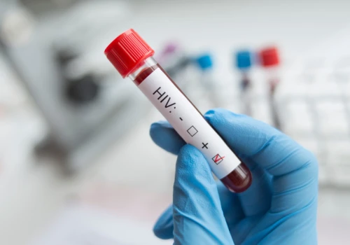Sejm: leczenie HIV także bez ubezpieczenia. Nowelizacja po wecie wraca do głosowania
